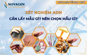 Xác định họ hàng nhờ xét nghiệm ADN